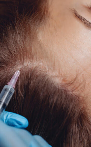 Beauty Kosmetikstudio Brisi Skin therapies treatments by Bris Oensingen Olten Kosmetische Behandlungen Plazmapen Peeling Dermapen-Behandlungen Hydrafacial Hyaloron Fettweg Spritze Hautverjüngung und Faltenreduktion Natürliche Ergebnisse Schnelle und langanhaltende Effekte Minimalinvasiv und anpassbar Verbesserung der Hautgesundheit Feuchtigkeitsversorgung Straffung und Festigung der Haut Geringe Ausfallzeiten