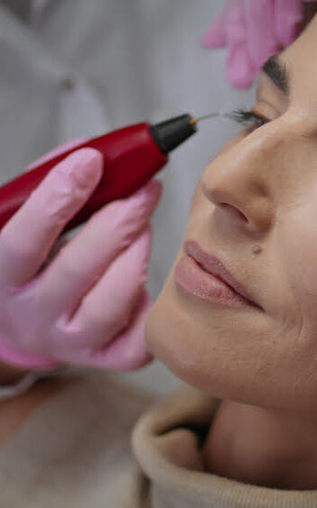 Beauty Kosmetikstudio Brisi Skin therapies treatments by Bris Oensingen Olten Kosmetische Behandlungen Plazmapen Peeling Dermapen-Behandlungen Hydrafacial Hyaloron Fettweg Spritze Hautverjüngung und Faltenreduktion Natürliche Ergebnisse Schnelle und langanhaltende Effekte Minimalinvasiv und anpassbar Verbesserung der Hautgesundheit Feuchtigkeitsversorgung Straffung und Festigung der Haut Geringe Ausfallzeiten